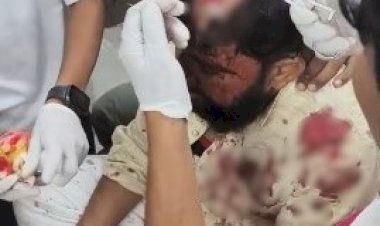 पुलिया के पास बाइक सवार युवक पर डंडे से हमला