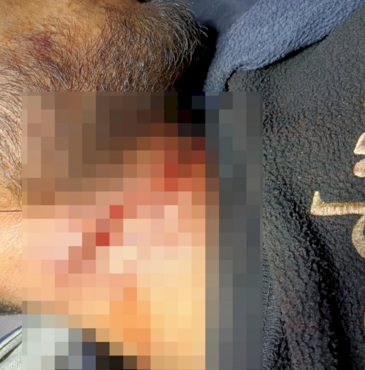 शाही में प्रेमिका को जबरदस्ती छीनने पर प्रेमी ने की आत्महत्या की कोशिश